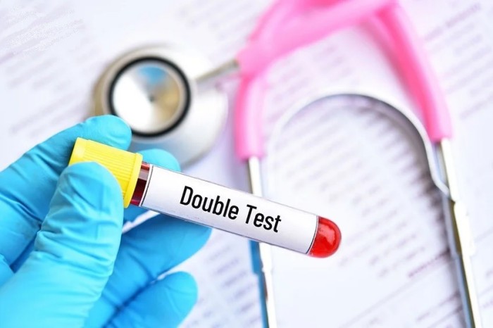 xét nghiệm Double test có được hưởng bảo hiểm không